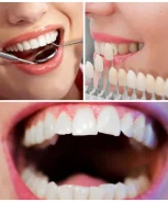 Best-Cosmetic-Dentist-in-NYC-1024x1024